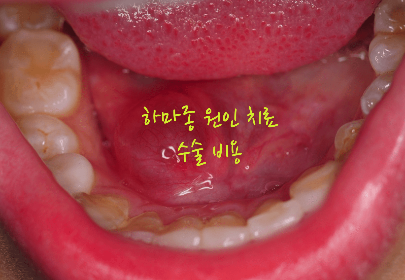 하마종