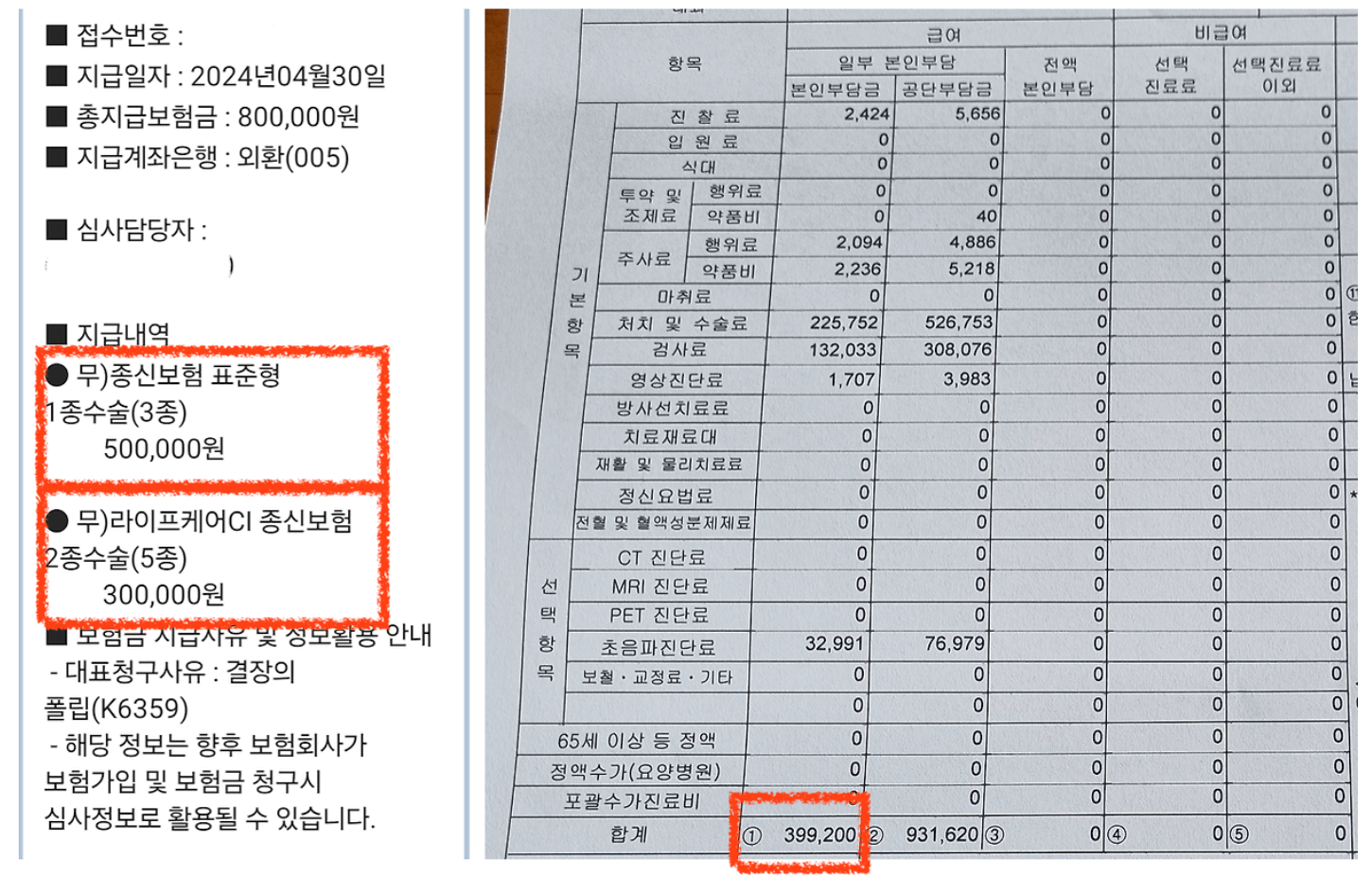 용종제거 비용