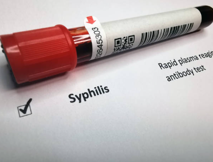 매독의 원인과 증상, 진단, 치료와 예방 방법, 합병증