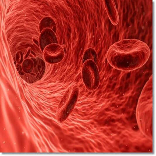 혈관 내 촬영 사진