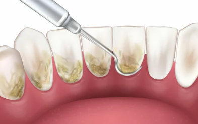 스케일링 이미지/출처:어도비스톡