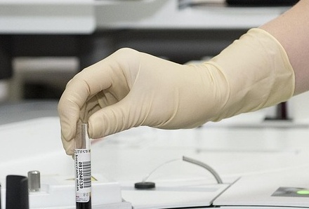 대상포진 치료방법