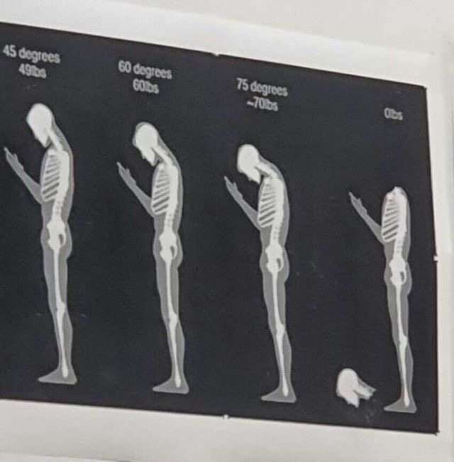 스마트폰은 거북목을 유발한다