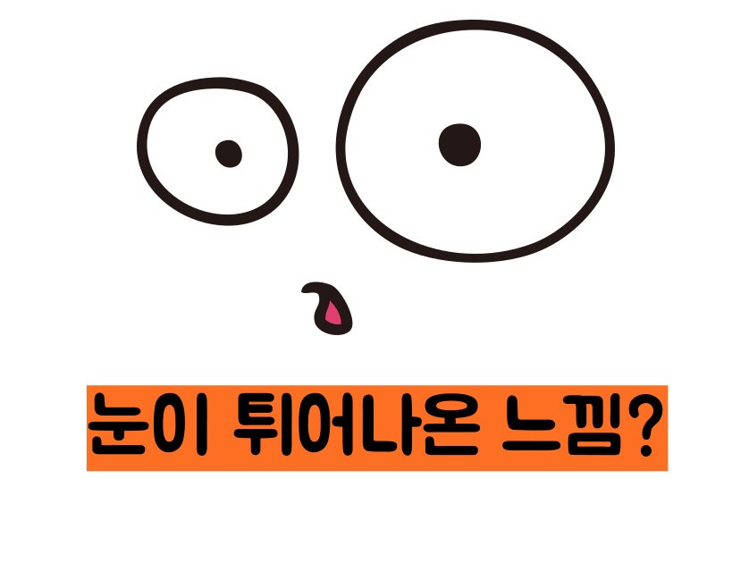 갑상선 기능 항진증 증상