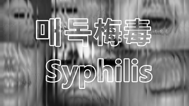 성병 매독(梅毒) Syphilis