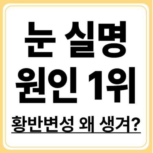 황반변성, 왜 생기나요? 유발원인, 생활습관 등