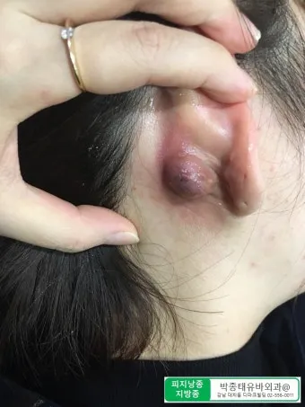 남자 얼굴 피지 제거 화장품 꿀템_20