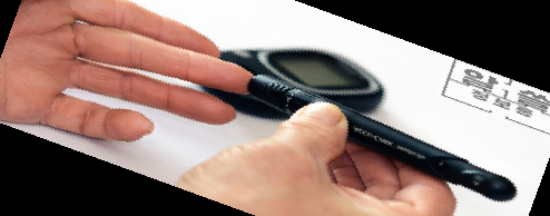 자일로 올리고당 분말 효능 가격