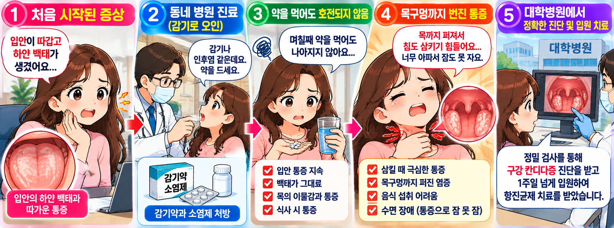 목 통증과 입안 백태 증상으로 초기 진단과 감별에 어려움을 겪는 모습