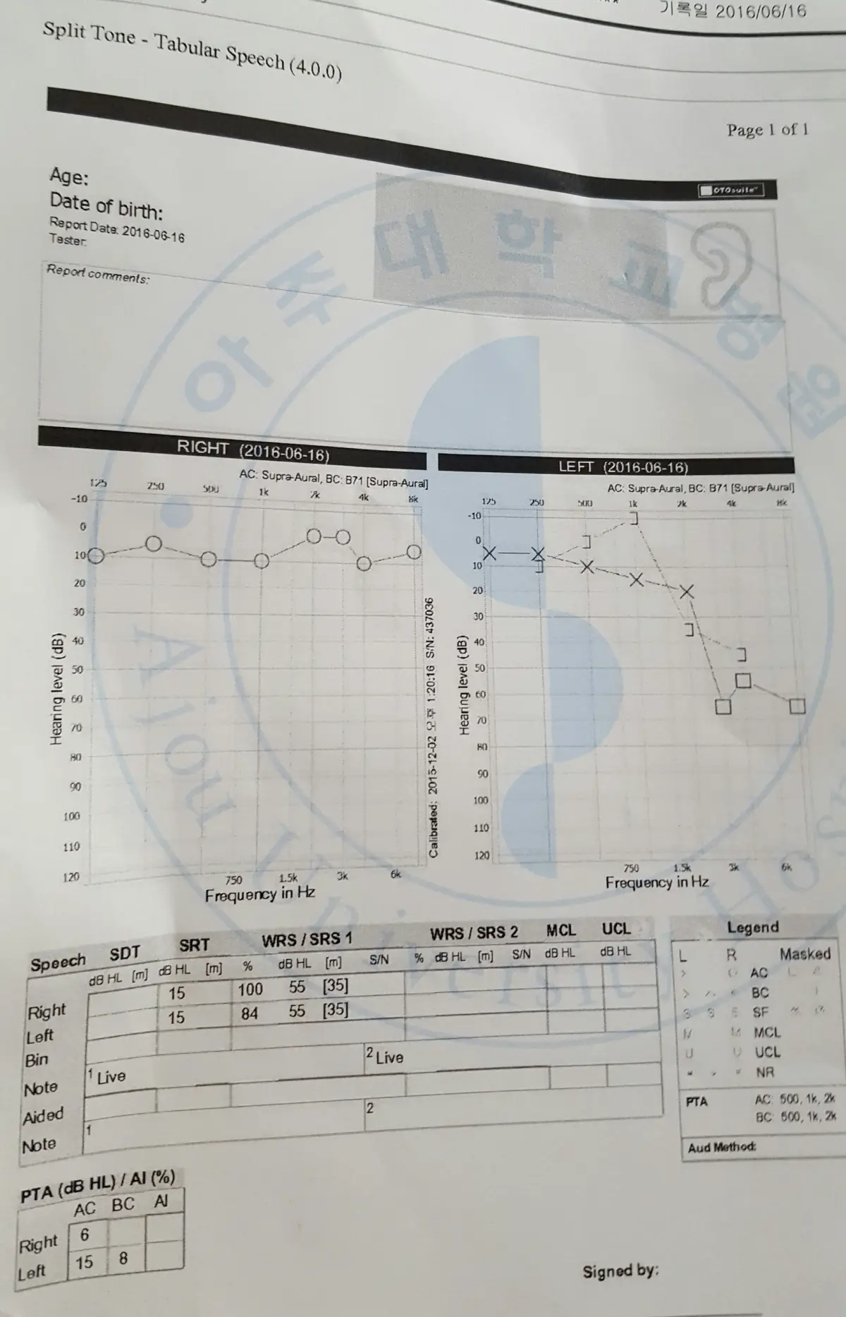 2016년 6월 16일자 아주대병원 청력검사 결과지