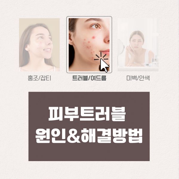 피부트러블 원인& 해결방법