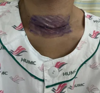 부갑상선기능항진증 수술 후기 2주차 내분비외과 내원 경험담_19