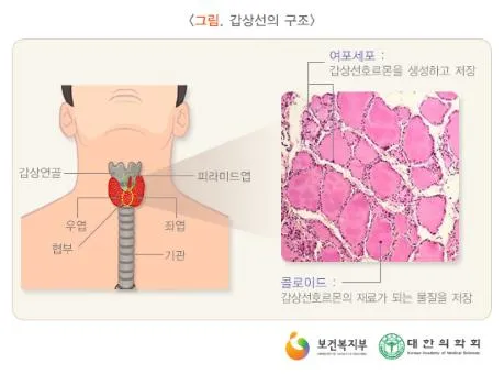갑상선 기능 저하증 증상 6가지는 무엇인지 알아보기_2
