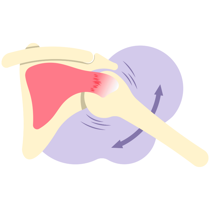 어깨 통증 원인 증상 치료법