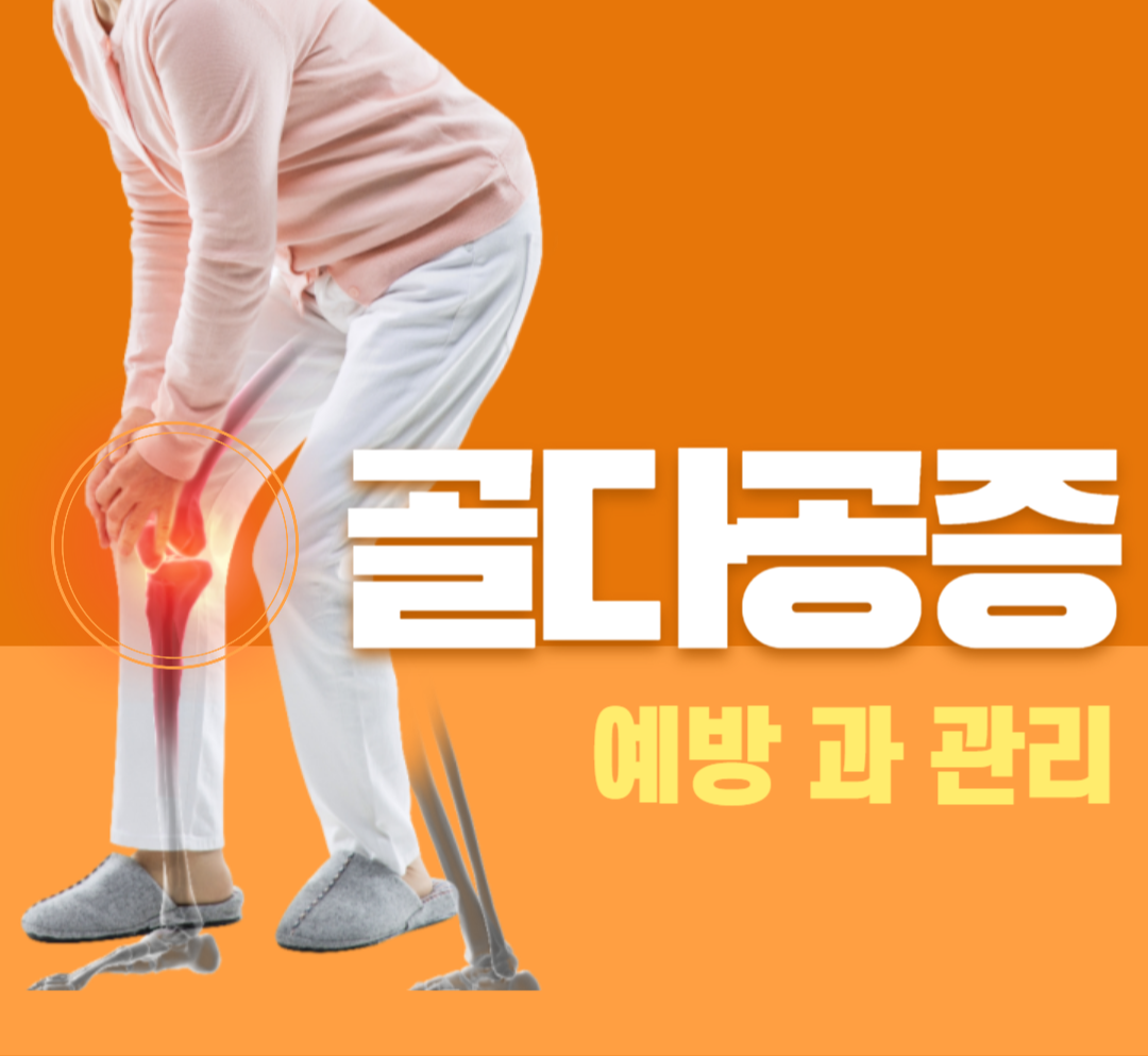골다공증 예방과 관리