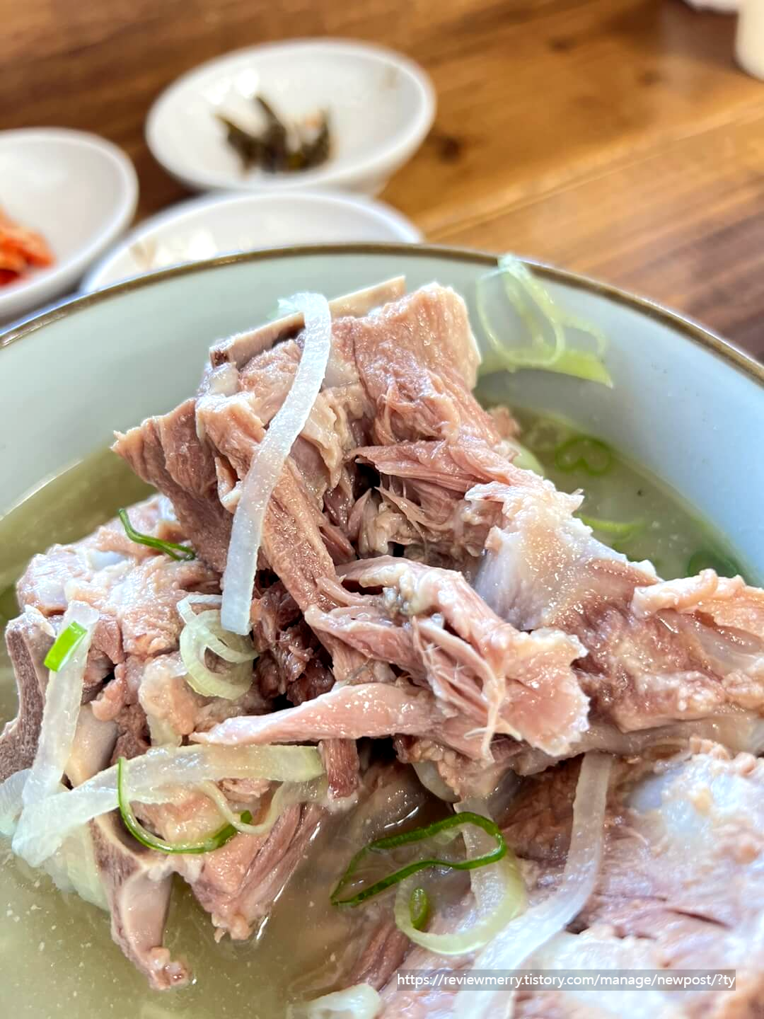 뼈 확대사진
