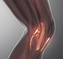 무릎 통증, 50대 이상 64%가 겪는 이유는?