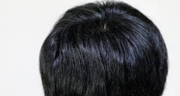 후두부 통증