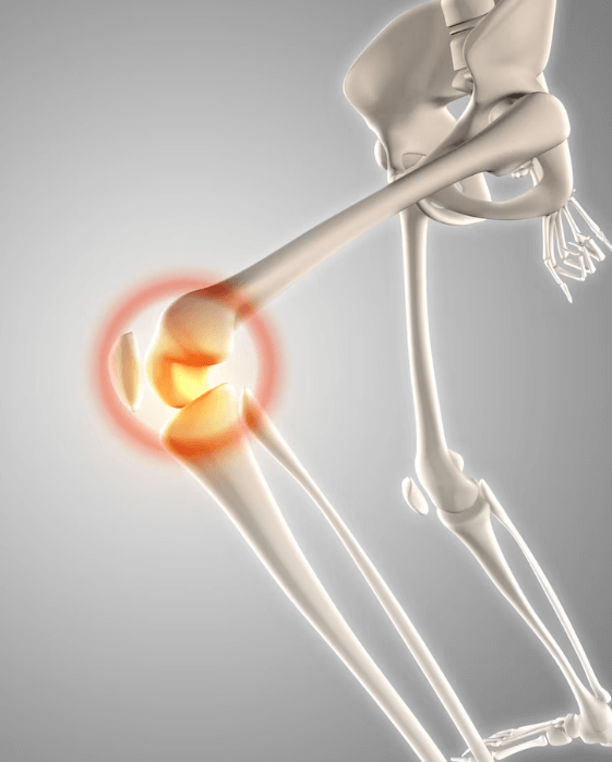당뇨병-환자-두유-섭취-시-주의할 점