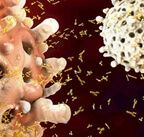  Monocyte 수치
