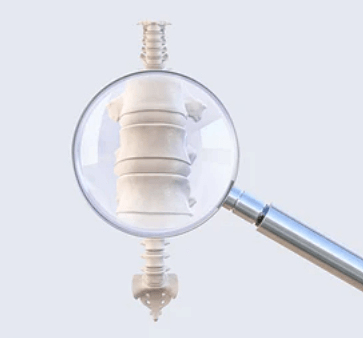 돋보기로-뼈를-관찰하는-모습