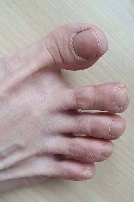 페디케어-전-정돈-안-된-내-발톱들