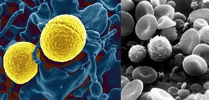 백혈구 정상 수치