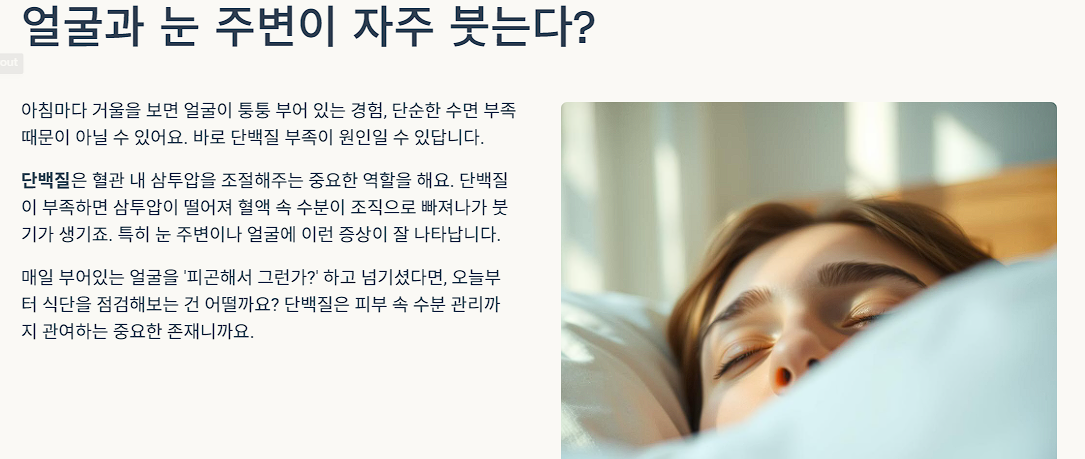 얼굴과 눈 주변이 자주 붓는다?