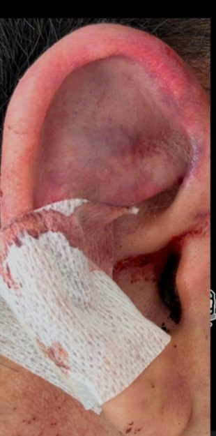 수탉 유튜버 납치 폭행 사건