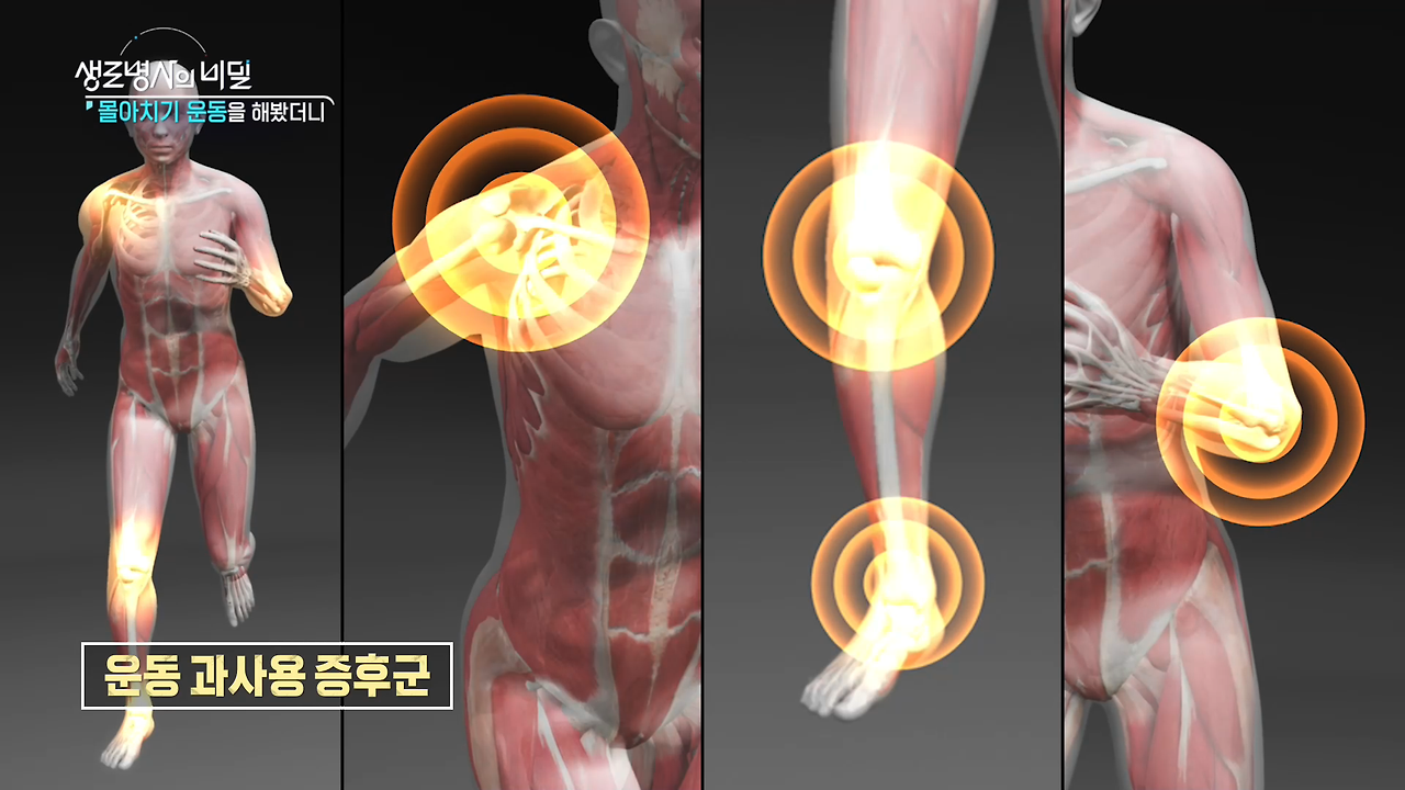 생로병사의 비밀 몰아치기 운동