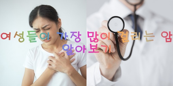 유방암