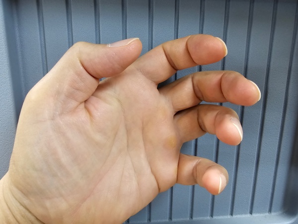 손가락을-구부린모습