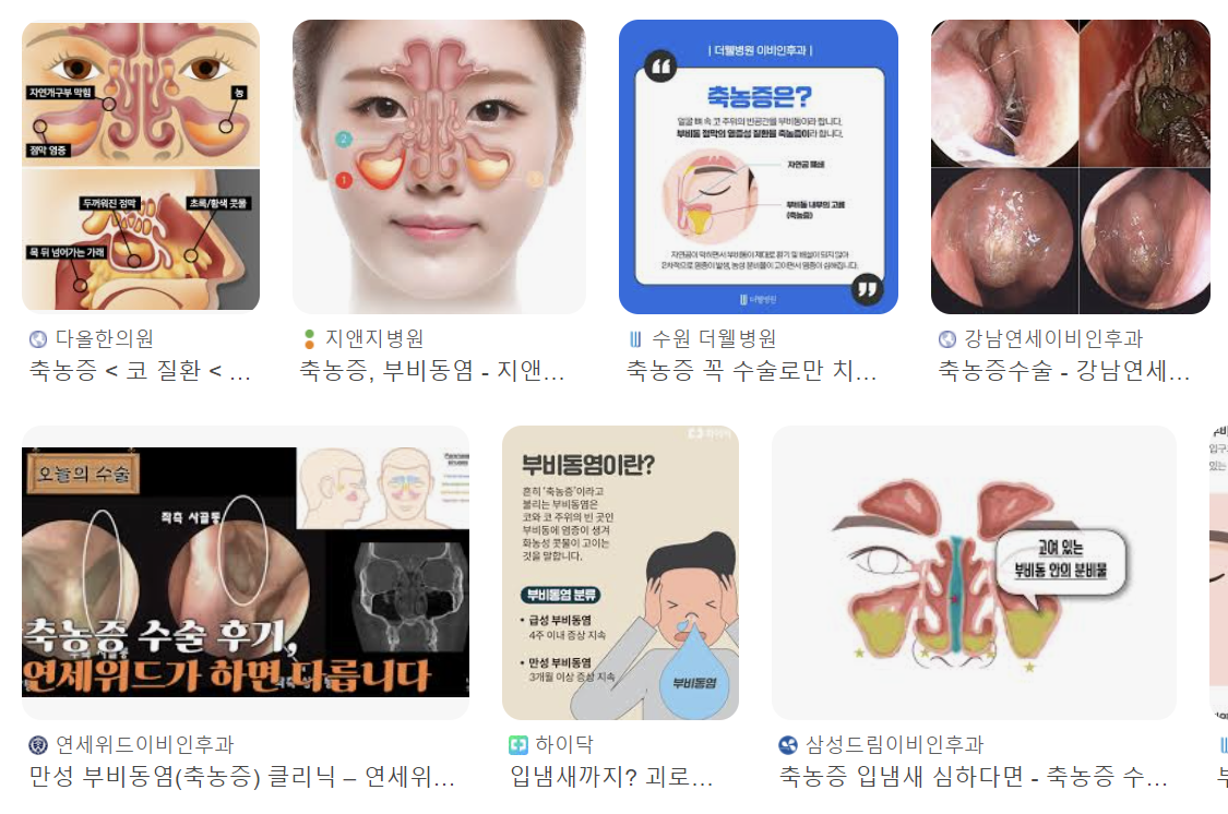 축농증 증상 2