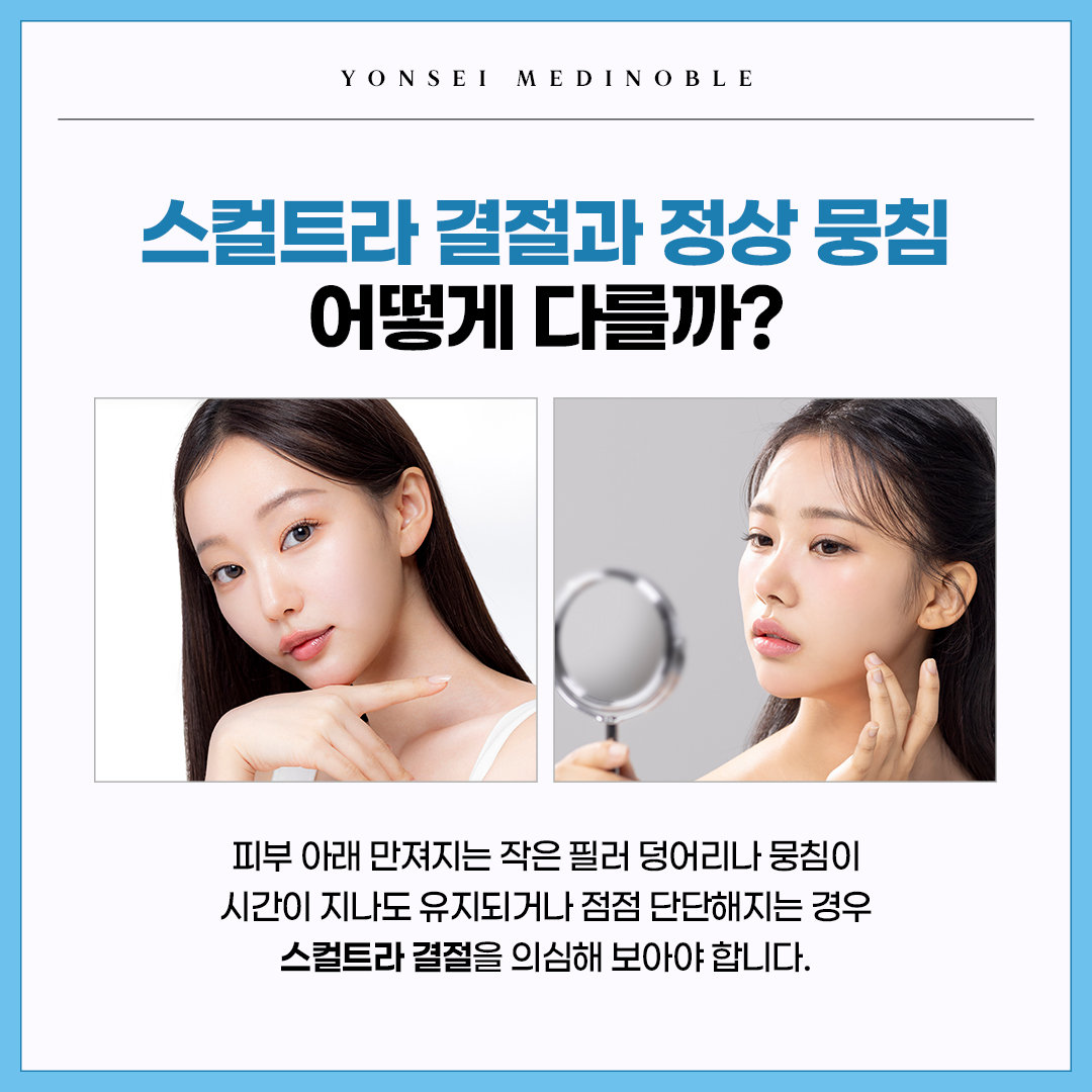 스컬트라 결절과 정상 뭉침 차이 비교