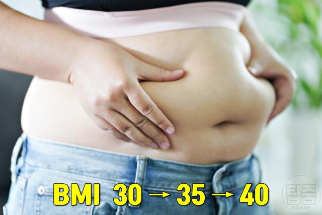 지방간 증상 비알코올성지방간 뱃살