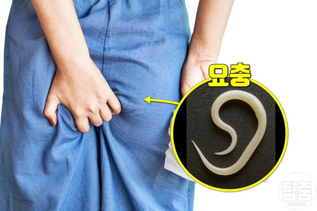 기생충 감염 증상 요충