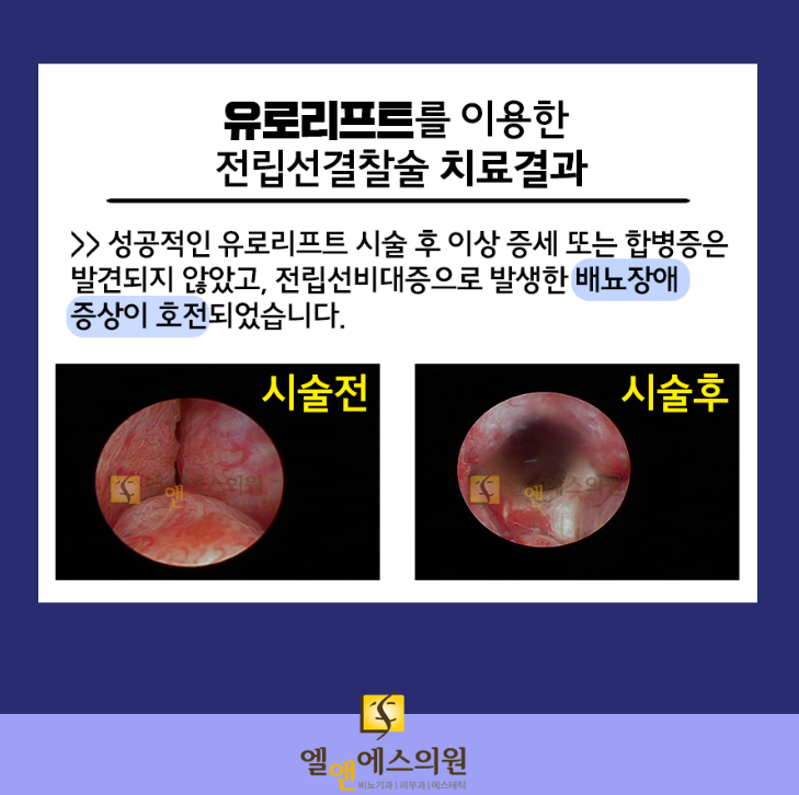 치료 결과