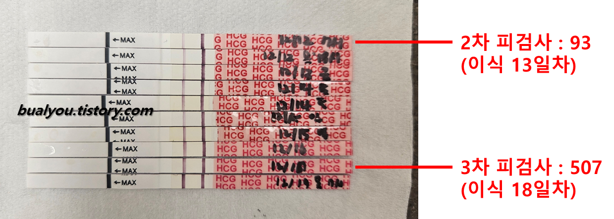 원포 임신 테스트기 피검사 수치