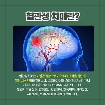 혈관성치매 원인 증상 치료법과 예방 생활습관_24