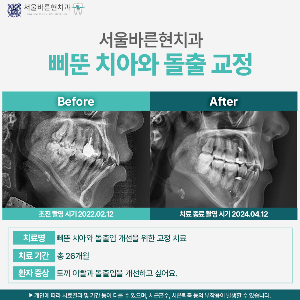 마린시티교정치과