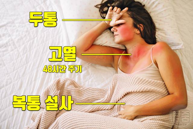 말라리아 증상 원인 말라리아 모기 물린 자국