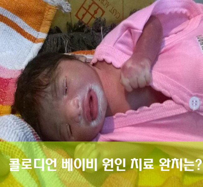 콜로디온 베이비 