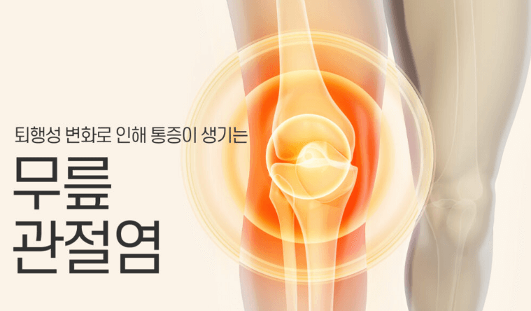 관절 영양제 추천&amp;#44; 관절 영양제 고를 때 주의사항