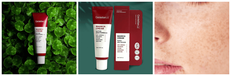 마데카크림, 기미 사진