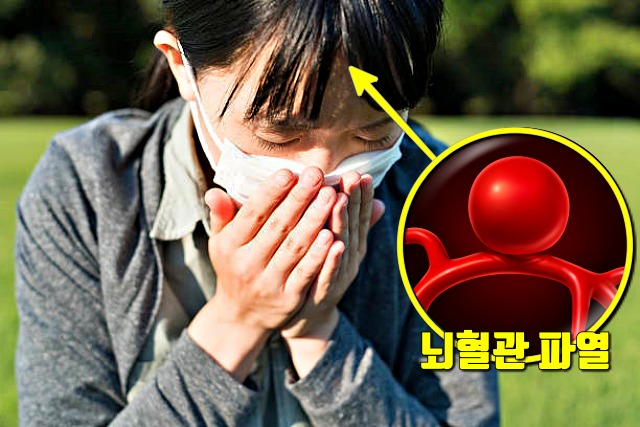 재채기 입막기 기도 고막 파열 증상 원인, 팁줌