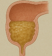 설사가 계속될 때