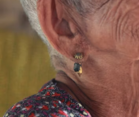 이석증 자가치료법 운동법 수면 자세