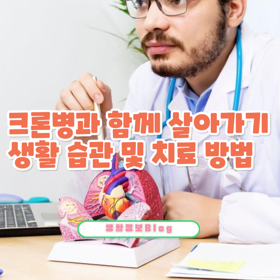 크론병에 대한 종합 가이드