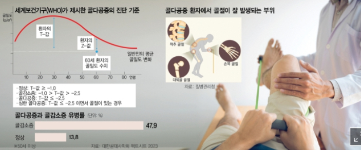 골다공증 주사 치료