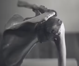 골다공증에 좋은 음식 10가지